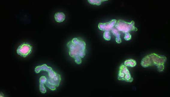 Organoides intestinales