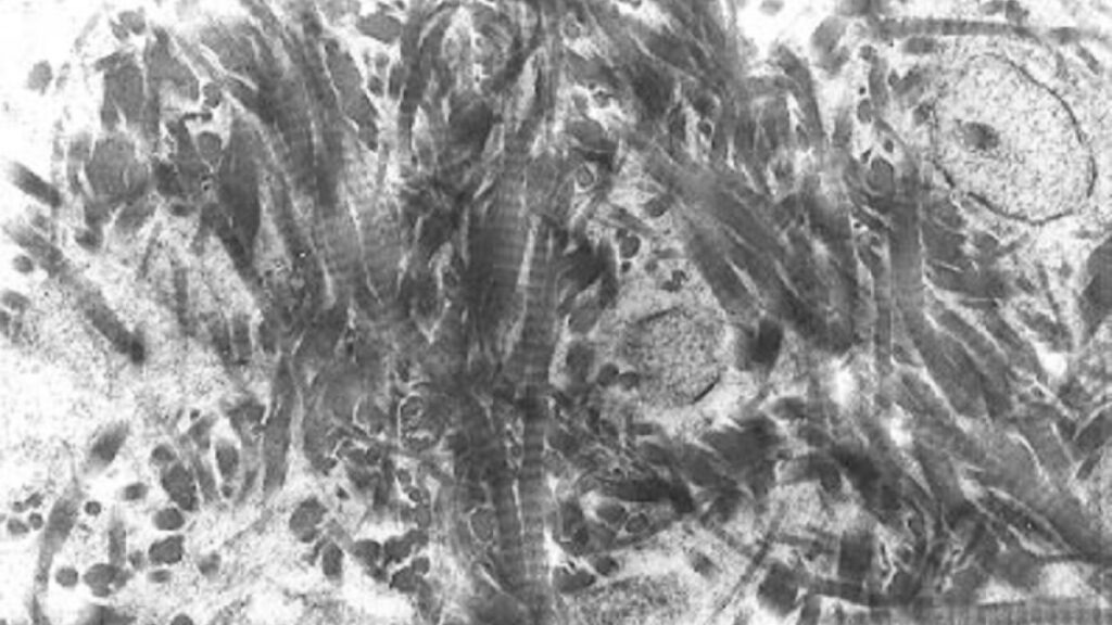 Organización fisicoquímica de la matriz ósea