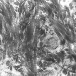 Organización fisicoquímica de la matriz ósea