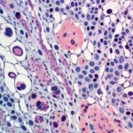 Nichos hematopoyéticos en la médula ósea