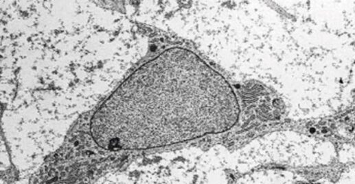 Diferenciación osteogénica de las células madre mesenquimales