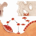 ¿Qué es el modelado óseo?