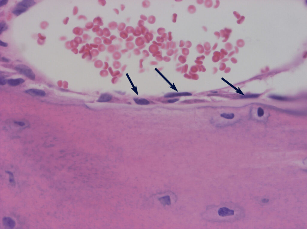 Nacimiento y muerte de los osteoblastos