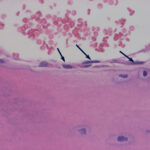 Nacimiento y muerte de los osteoblastos