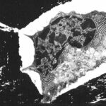 Metabolismo de la Glucosa en Osteocitos