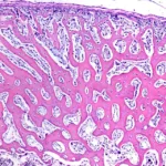 Osificación intramembranosa