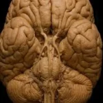 Base del cerebro