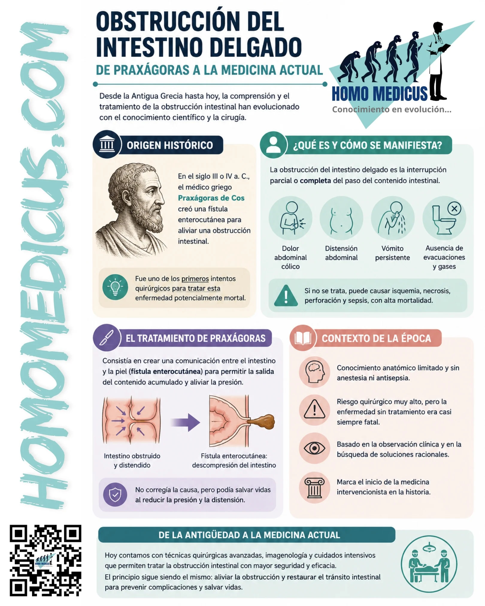 Contribución de praxágoras al tratamiento de la obstrucción intestinal