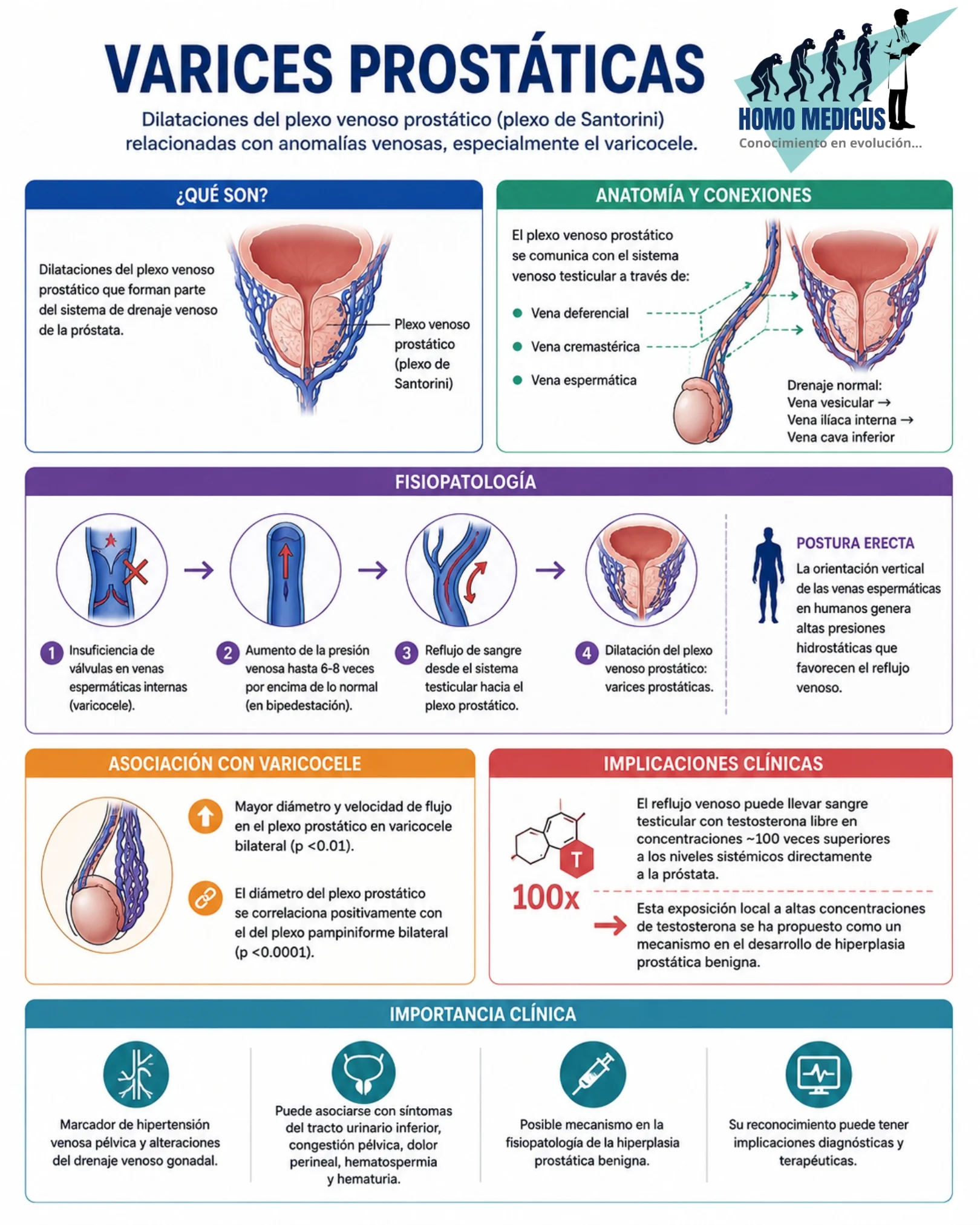 VARICES PROSTÁTICAS VARICES PROSTÁTICAS