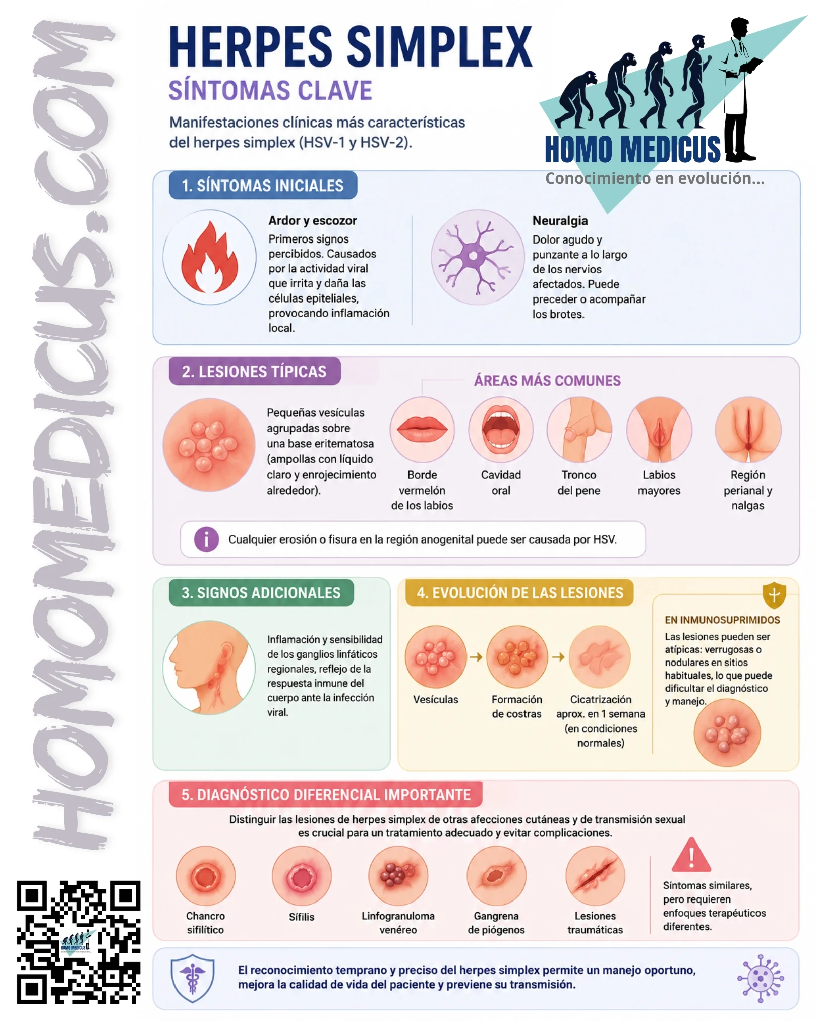HERPES SIMPLE HERPES SIMPLE